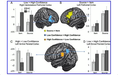 Quantitative And Qualitative Activity In Prefrontal And Parietal