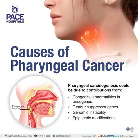 Pharyngeal Cancer Causes Symptoms Stages Prognosis