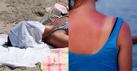 Skin Cancer Everything You Should Know