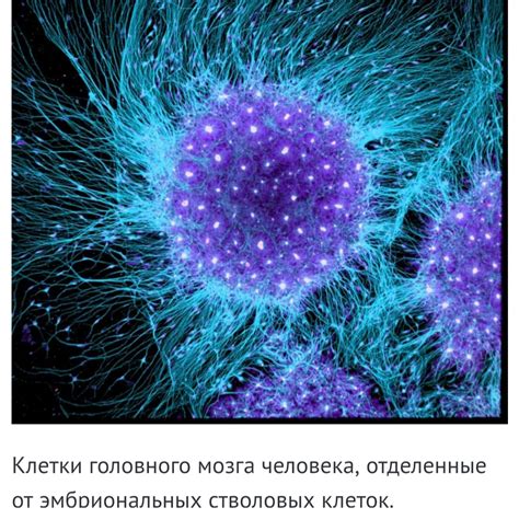 Невероятные фотографии под микроскопом | Пикабу