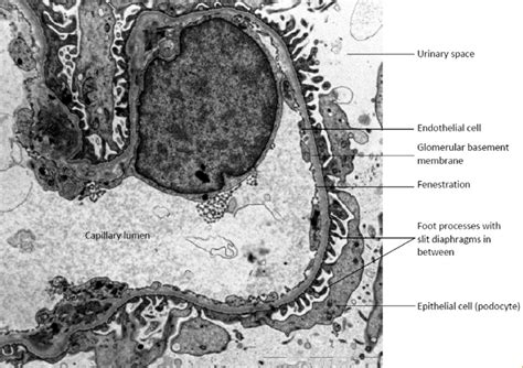 Electron Micrograph Of A Normal Glomerular Filtration Barrier