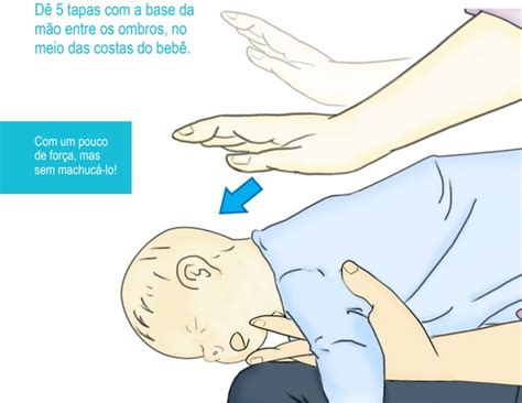 Engasgar Do Nada O Que Pode Ser - Se o seu bebê engasgar, você saberia o que fazer? - Revista Crescer ...