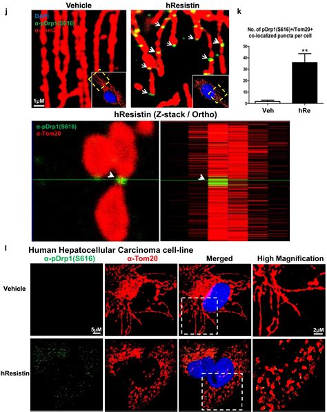 Resistin Impairs Mitochondrial Homeostasis Via Cyclase Associated