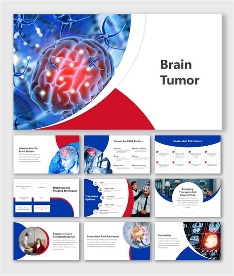Brain Tumor Ppt
