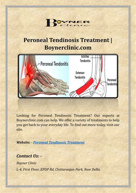 PPT - Peroneal Tendonitis Treatment | Boynerclinic PowerPoint ...