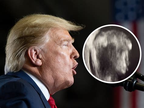 I Couldnt Unsee It Expectant Parents Told Baby Looks Like Donald