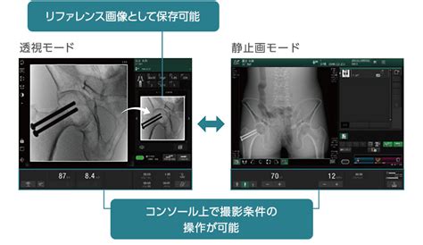 Calneo Cross 画像処理技術 富士フイルム 日本