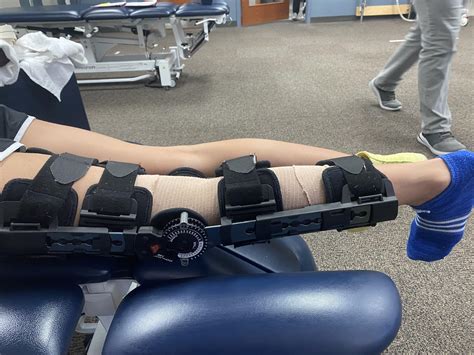 After a month at PT I managed to straighten my leg almost completely