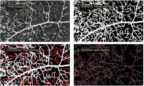 Figure From Automated Segmentation And Analysis Of Retinal Microglia