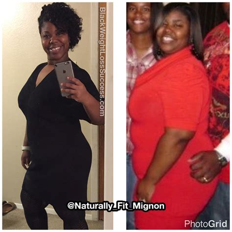 Mignon Lost 100 Pounds Black Weight Loss Success