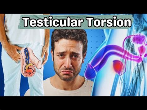 Testicular Torsion What Happens In Testicular Torsion Symptoms