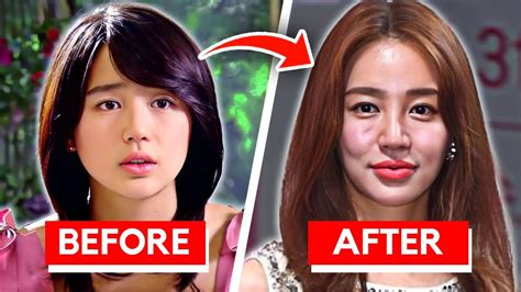 Korean Actors Who Ruined Their Face With Too Much Plastic Surgery