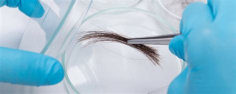 Hair Follicle Analysis