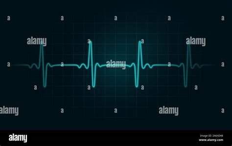 Pulse rate Line on green chart background of monitor. Illustration ...