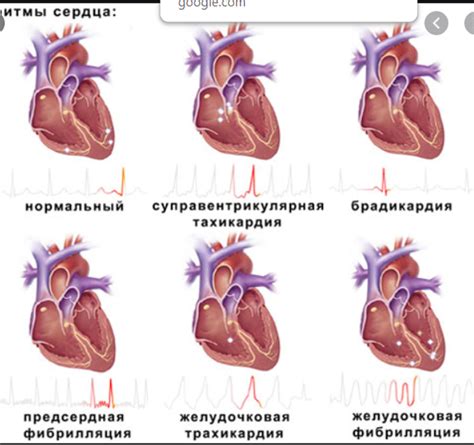 Симптомы тахикардии: тахикардия после еды, у детей, в разное время суток