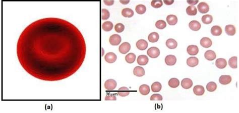 (a) Represents RBC Shape and (b) RBCs at Higher Magnification. [23 ...