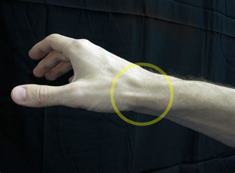Mommy Thumb Do You Recognize These Five Signs