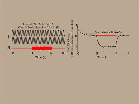 Systems Neuroscience of Auditory Perception - Purdue University