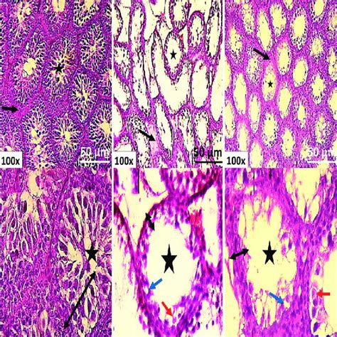 Histological Examination Of Testicular Sections Stained With