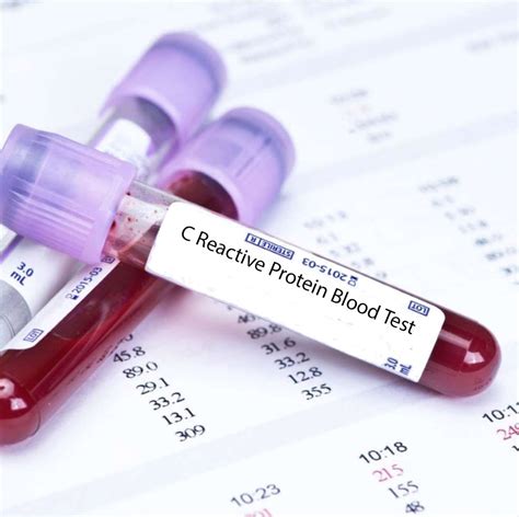 More blood and intestinal markers of inflammation you should know about