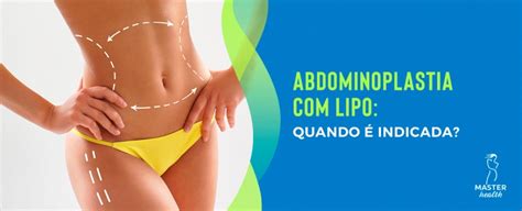 Categoria Abdominoplastia P Gina De Blog Master Health