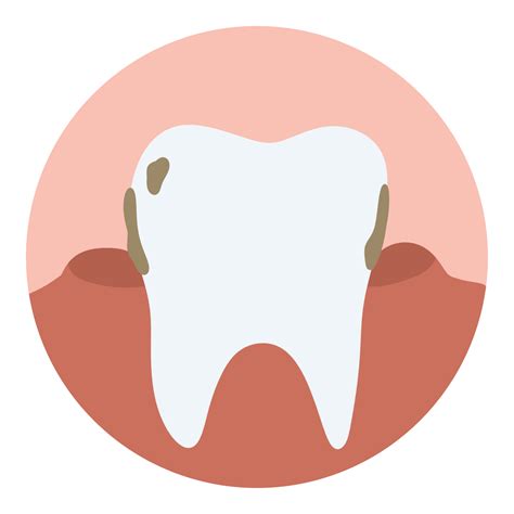 Toothpaste Causes Tooth Decay at Susan Taube blog