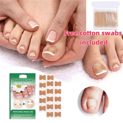Toenail 50 Pcs No Glue Breathable Corrector Patch Toenail Corrector