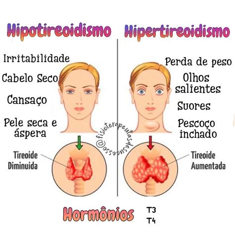 Remedios Caseros Para Tratar El Hipertiroidismo Artofit