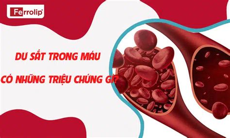 du sat trong   nhung trieu chung gi bien phap khac phuc