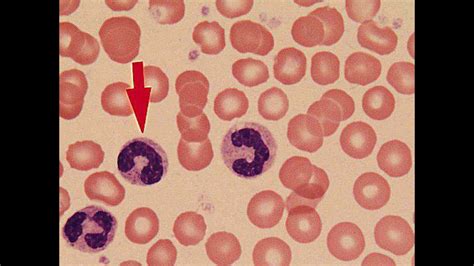 Кровь. - YouTube