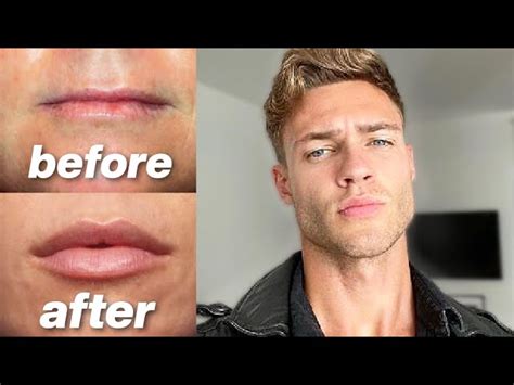 Thin Lips Men