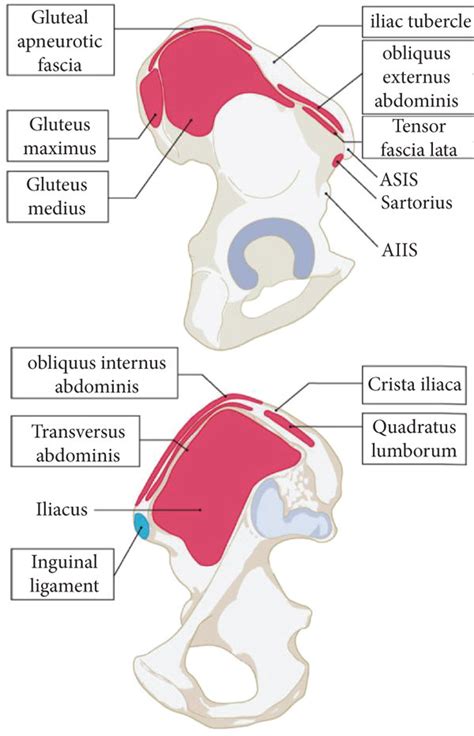 Important anatomical structures of the iliac crest. Iliac crest is ...