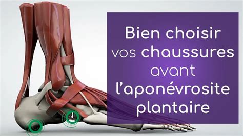 Bien choisir vos chaussures avant laponévrosite plantaire ou