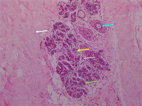 Atlas Of Breast Cancer Early Detection
