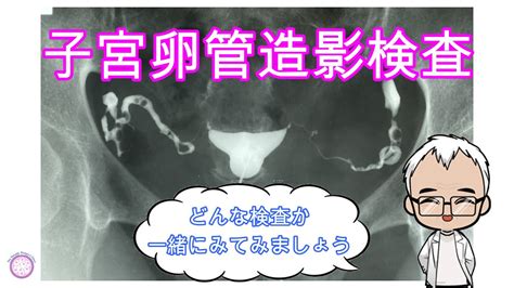 子宮卵管造影検査について 名古屋市不妊治療専門 さわだウィメンズクリニック培養室ブログ