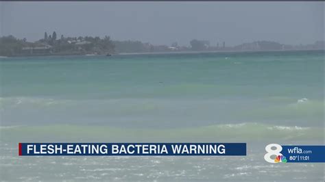 Rare Flesh Eating Bacteria Has Killed 5 In Tampa Bay Area Since