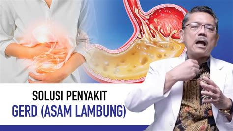 Gerd Penyakit Asam Lambung Gejala Penyebab Dan Cara Mengatasi