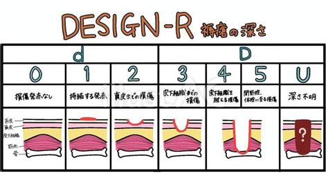 design   ac