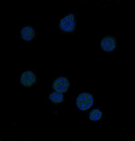 Bcl 6 Rabbit MAb 25QP Nature Biosciences Kit MAb