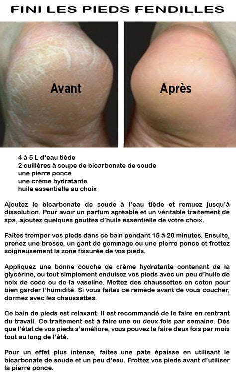 Astuce Naturelle Pour Traiter Les Pieds Secs Et Fendill S Pied Sec