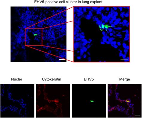 Monoclonal Mouse Anti Pan Cytokeratin Antibody Agilent Technologies