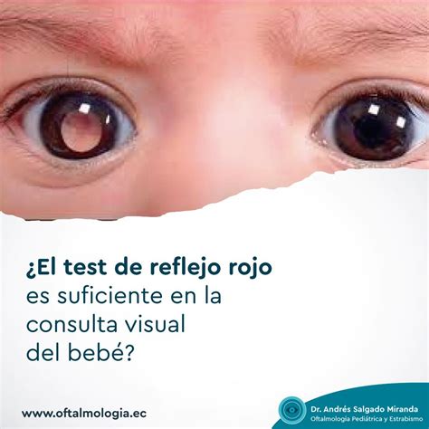 el test del reflejo rojo nos permite identificar enfermedades oculares