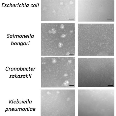 Transmission Electron Microscopy Analysis Of Isolated Mcps Samples Download Scientific Diagram