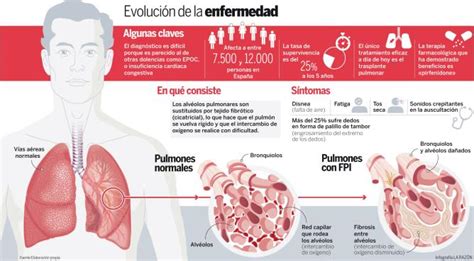 Fibrosis Pulmonar Idiopática | Medicusmeo