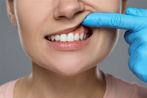 The Impact Of Periodontal Disease On Your Oral Health What You Need To Know Torrey Hills