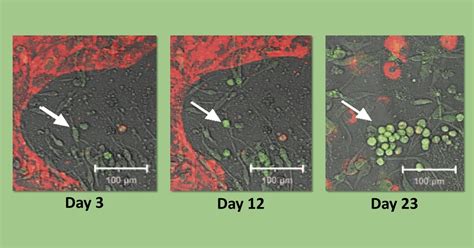 Endothelial Cells Nih Directors Blog