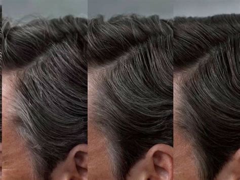 El Verdadero Origen De Las Canas No Es La Edad