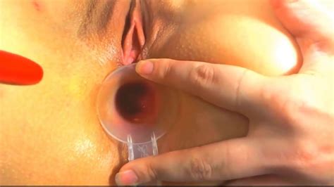 Deutsch Blone Babe Doktor