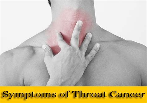 Symptoms: Throat Cancer Symptoms