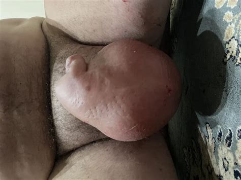 Saline Balls Fun Gay Amateur Amateur Porn Feat SALINEBALLSUK84 XHamster